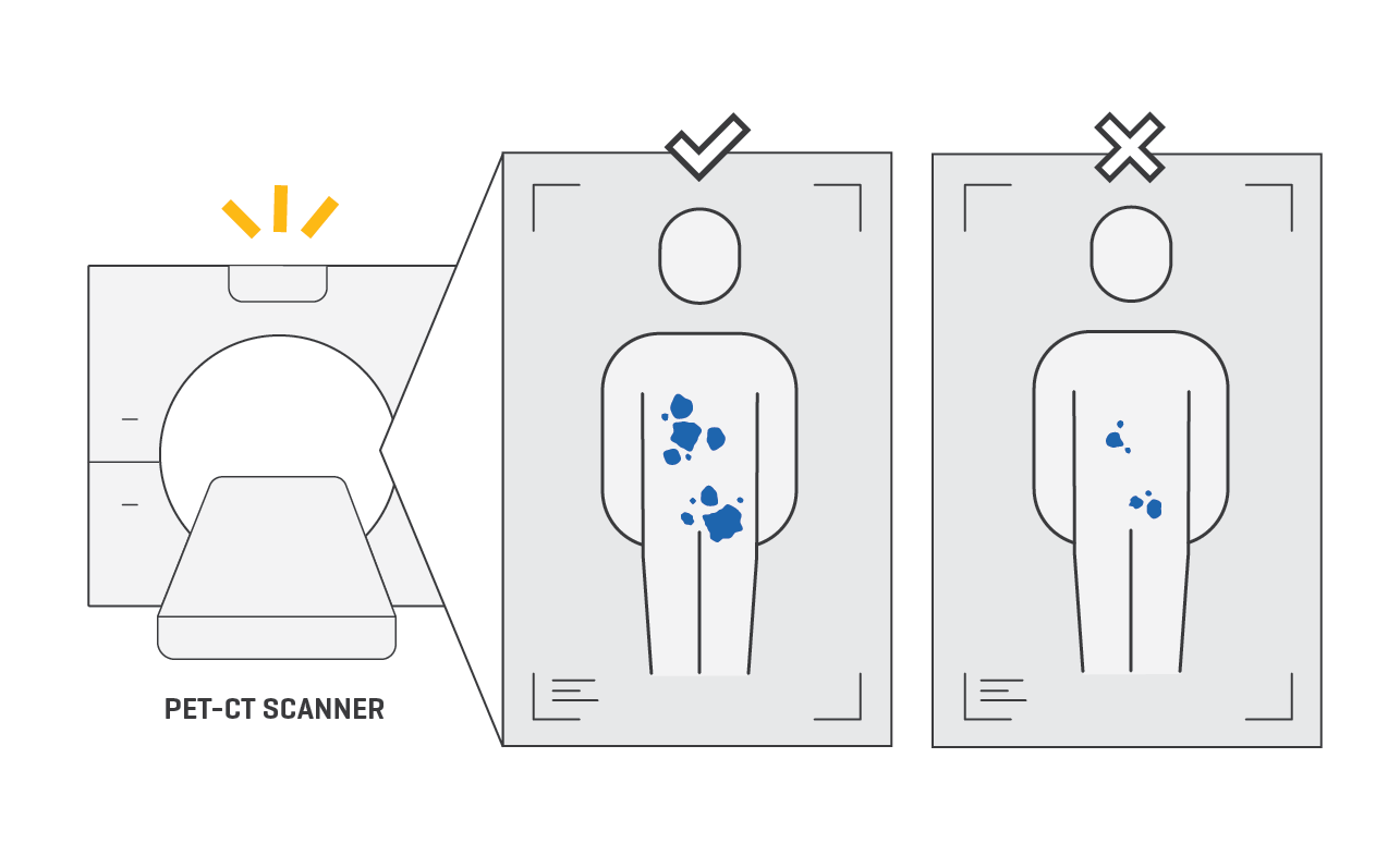 Illustration of scanning in a PET-CT machine